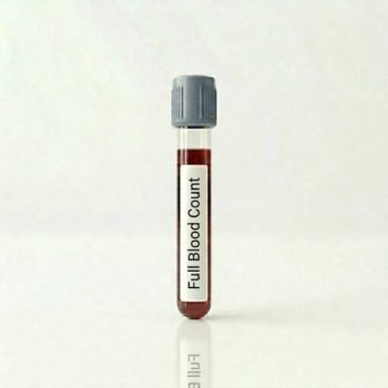 Full Blood Count (FBC)